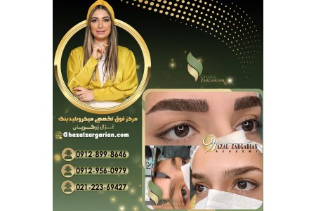 جدیدترین روش فیبروز در تهران