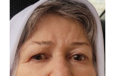 ساخت چشم مصنوعی
